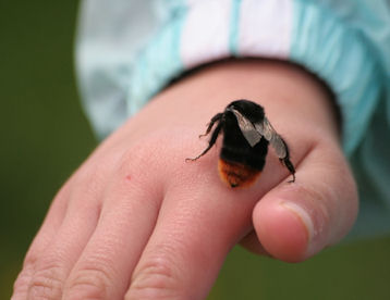 bee on child's hand